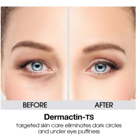 Dermactin-TS Cooling Puffy Eye Treatment .34oz/10 ml - Picture 5 of 6
